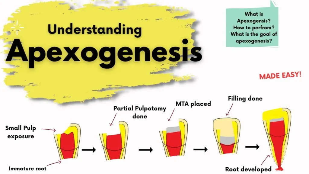 Apexogenesis