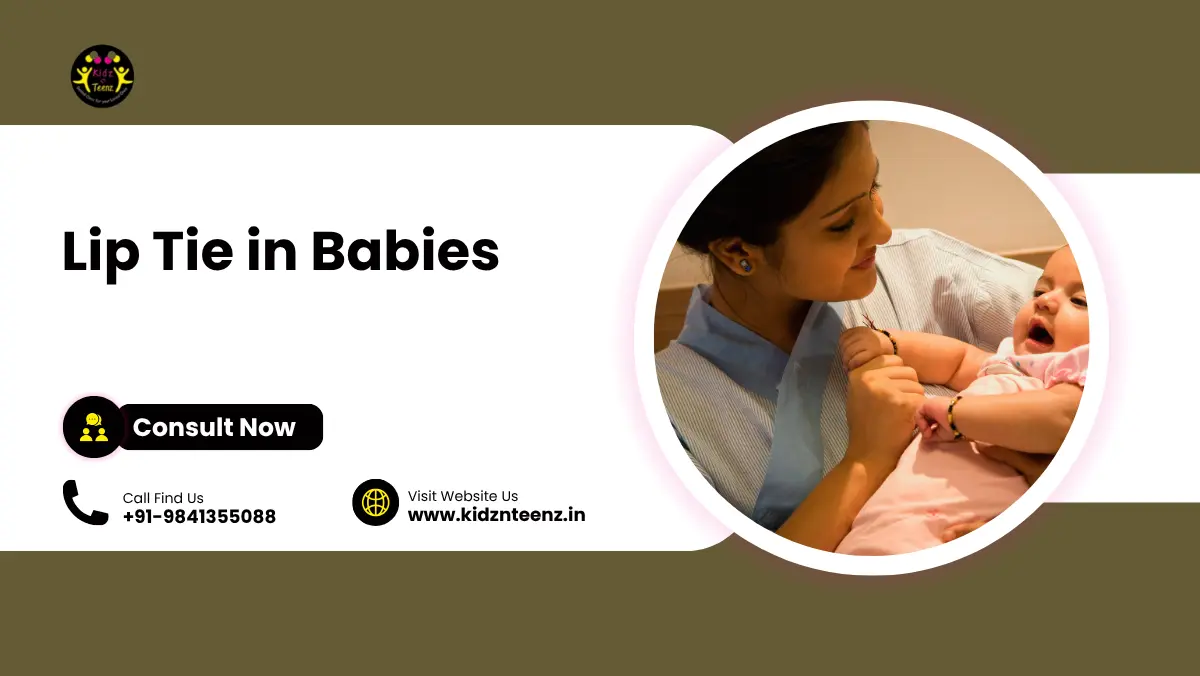 Lip Tie in Babies