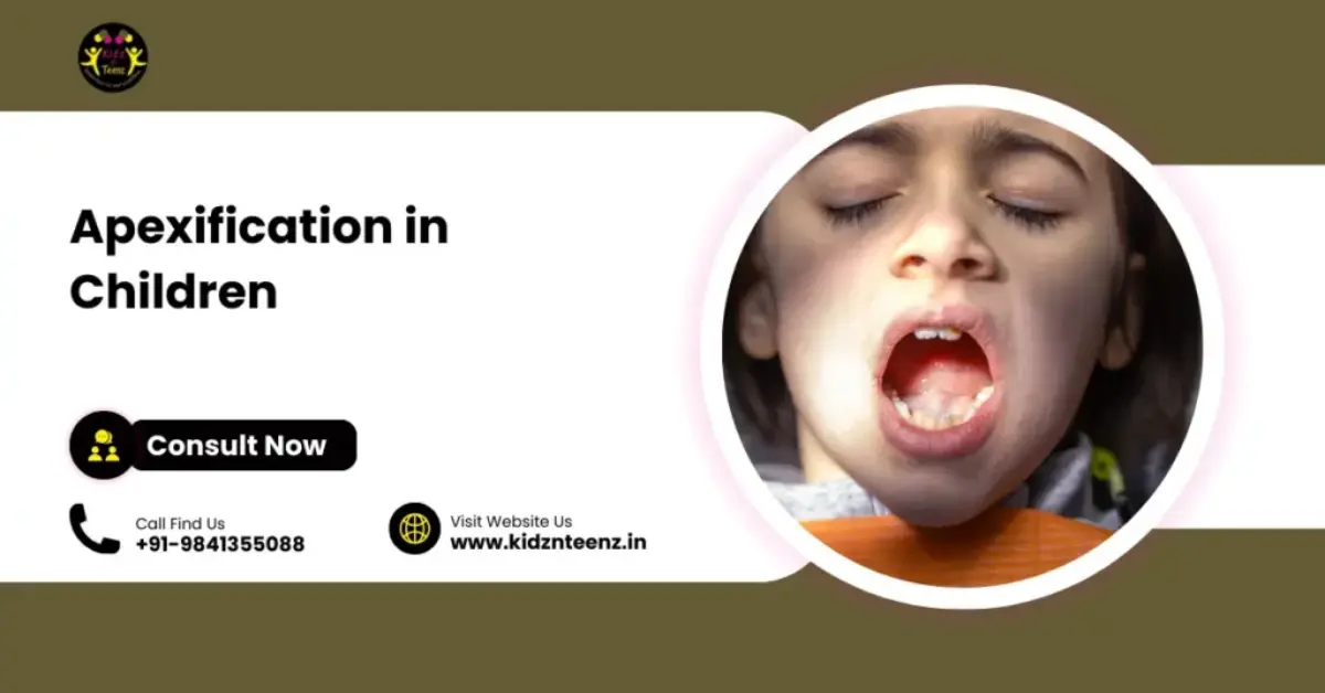 Apexification in Children