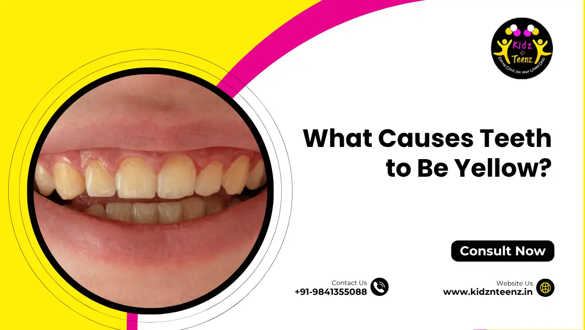 What Causes Teeth to Be Yellow? Top Reasons and How to Fix Them